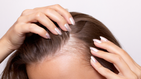 دواء فموي جديد يحقق نتائج واعدة لنمو الشعر في 6 أشهر