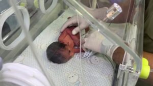 وزارة الصحة في غزة تحذر من ارتفاع مقلق في حالات الإجهاض